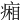 𤷼